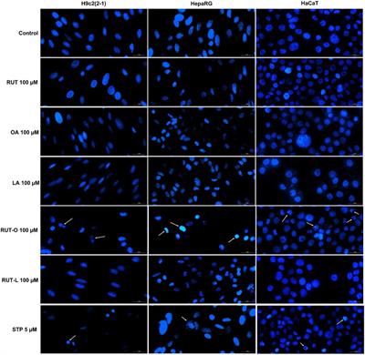 Rutin bioconjugates as potential nutraceutical prodrugs: An in vitro and in ovo toxicological screening